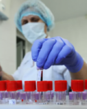 ОПЕРАТИВНА ІНФОРМАЦІЯ ПРО ПОШИРЕННЯ КОРОНАВІРУСНОЇ ІНФЕКЦІЇ COVID-19 В УКРАЇНІ ТА КИЇВСЬКІЙ ОБЛАСТІ