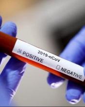 Перший випадок захворювання на коронавірус виявлено на Київщині