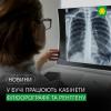 Регулярна діагностика – важливий крок до збереження здоров’я: у Бучанському консультативно-діагностичному центрі працюють кабінети флюорографії та рентгену.
